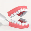 Electric Tartar Remover 