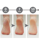 Professional Foot File Callus Remover